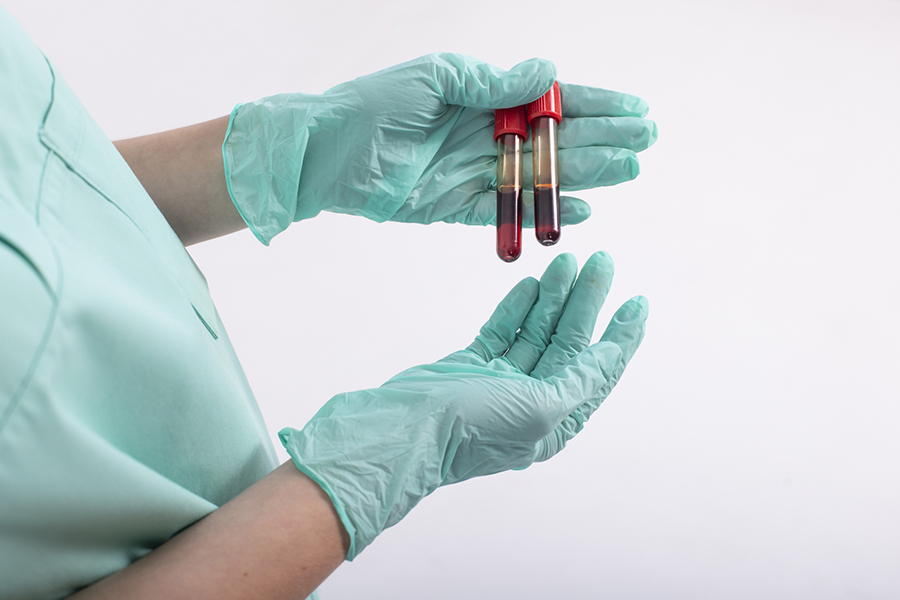 採血・尿検査で生活習慣病の早期発見を