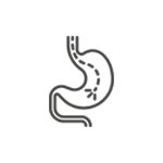 上部内視鏡検査